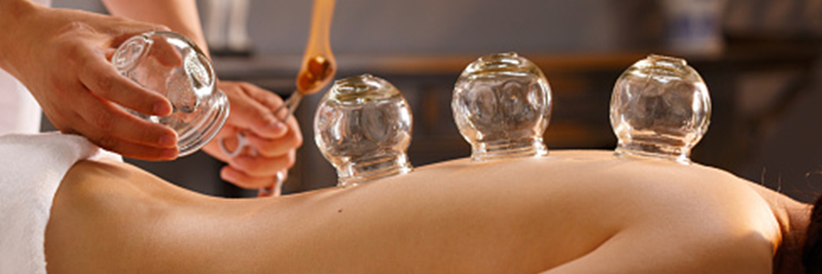 Acupunctuur Heerenveen cuppen en massages behandelmethoden