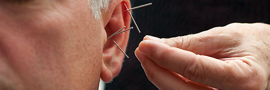 Acupunctuur Heerenveen ooracupunctuur behandelmethoden