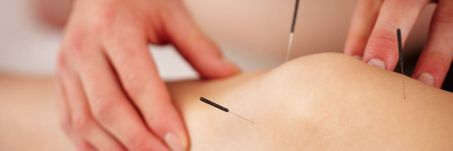 Acupunctuur Heerenveen pijnbestrijding