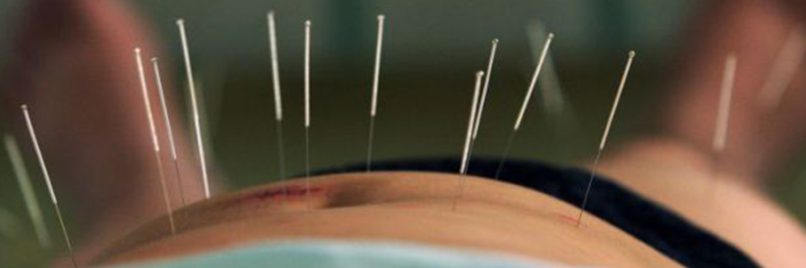 Vrouwenproblematiek bestrijden door middel van Acupunctuur Heerenveen
